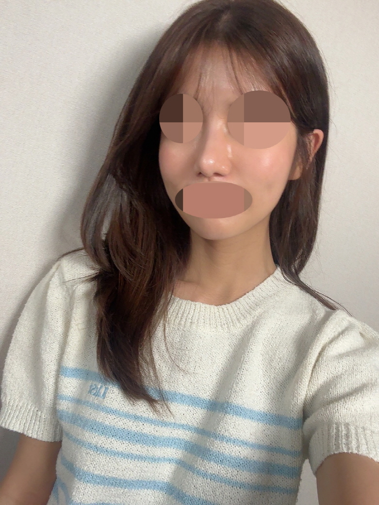 수술후기이미지