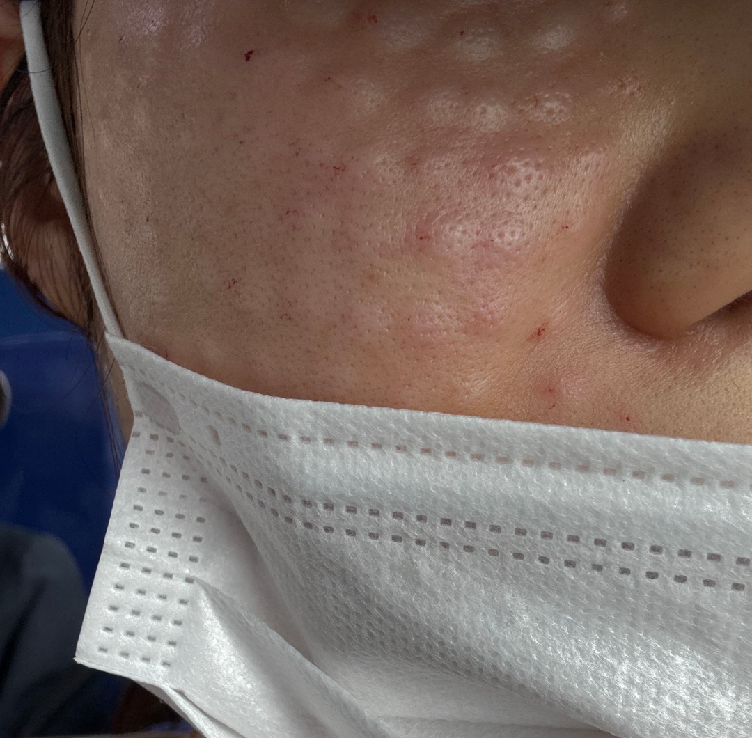 수술후기이미지