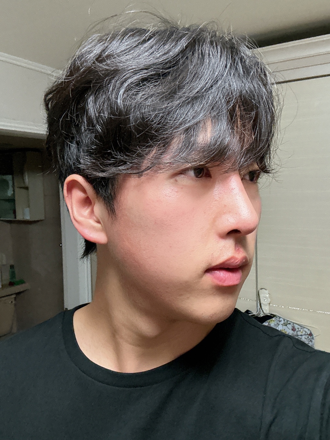 수술후기이미지