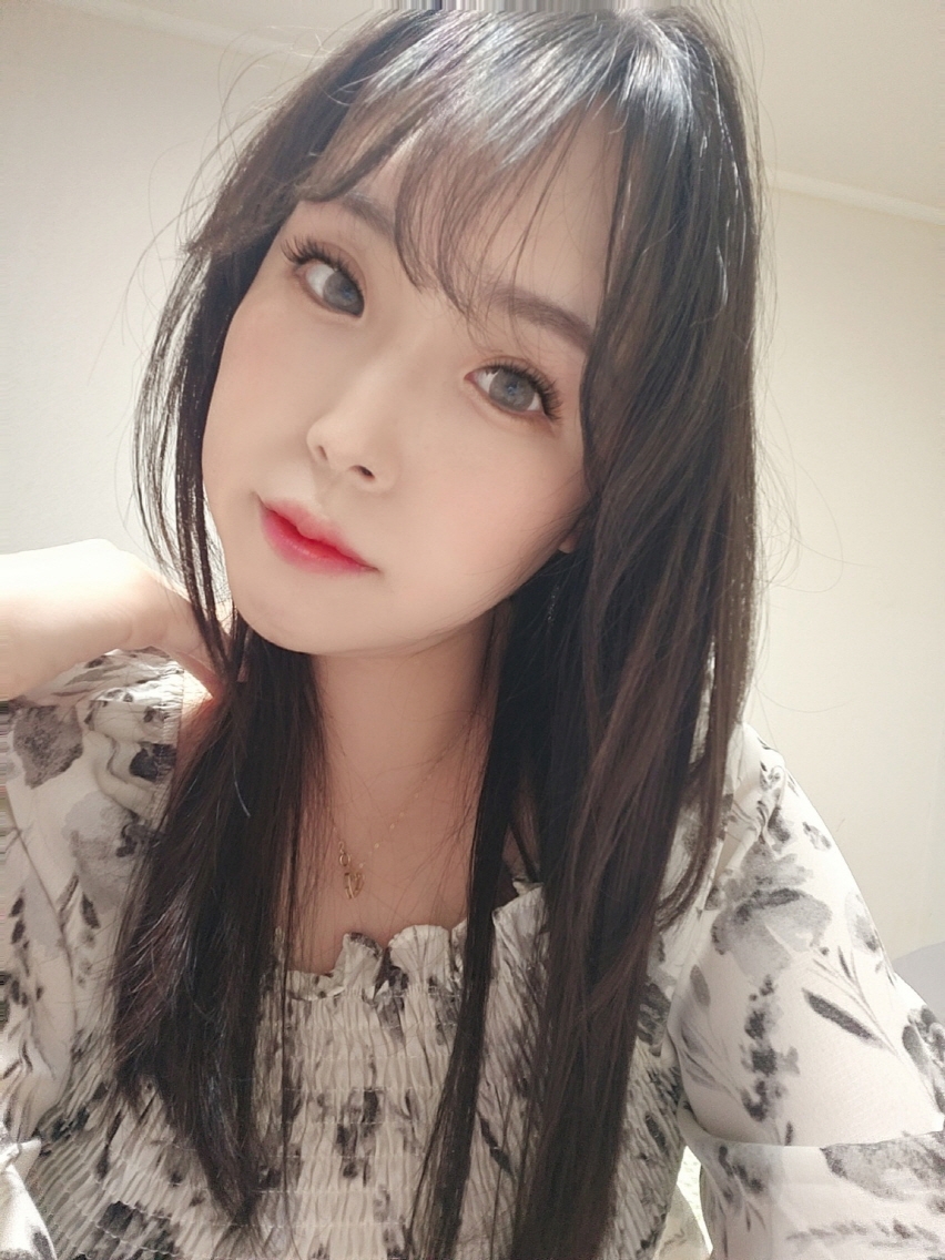 수술후기이미지