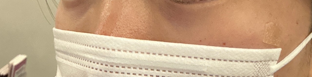 수술후기이미지