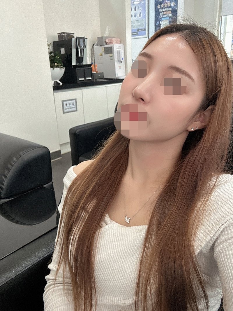 수술후기이미지