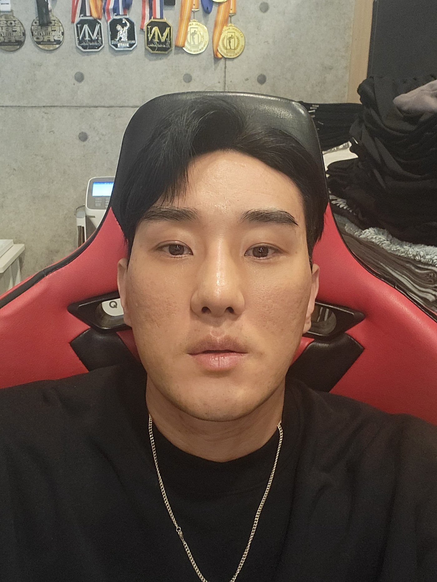 수술후기이미지