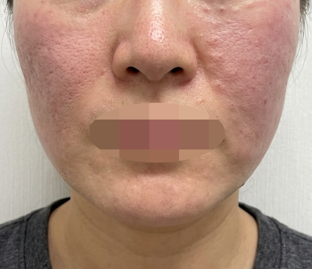 수술후기이미지