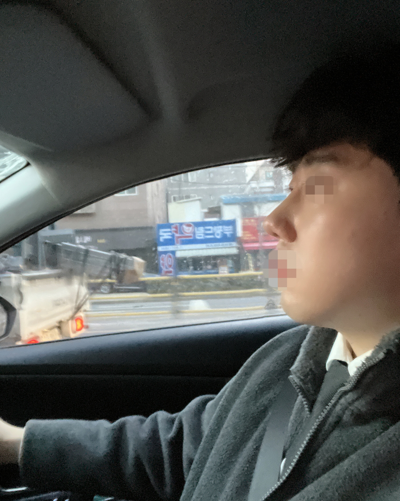 수술후기이미지