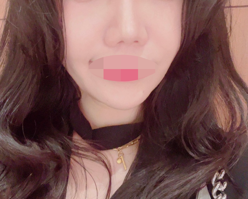 수술후기이미지