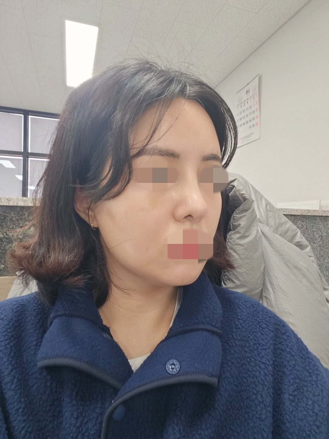 수술후기이미지