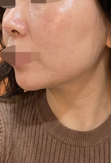 수술후기이미지