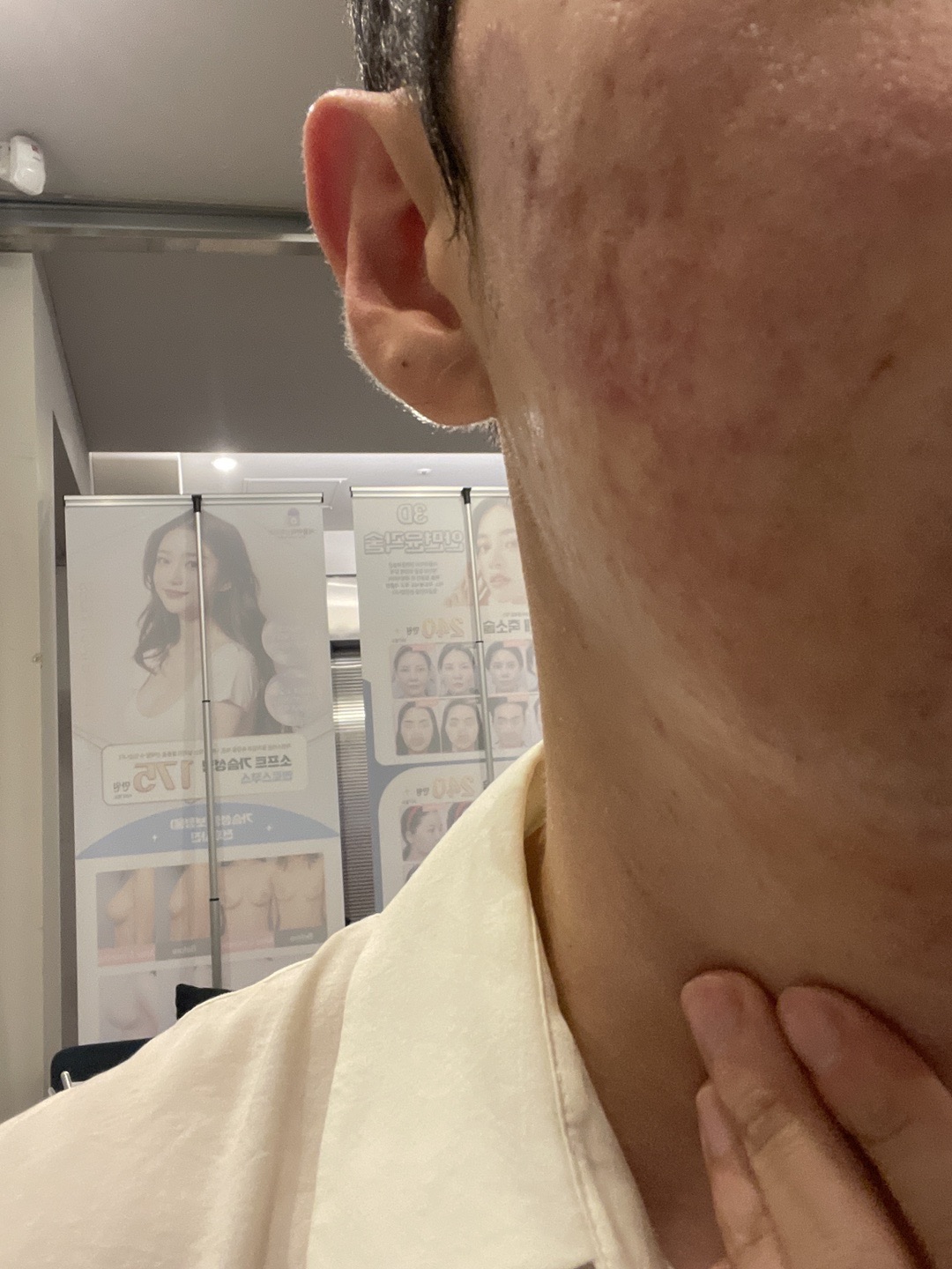 수술후기이미지