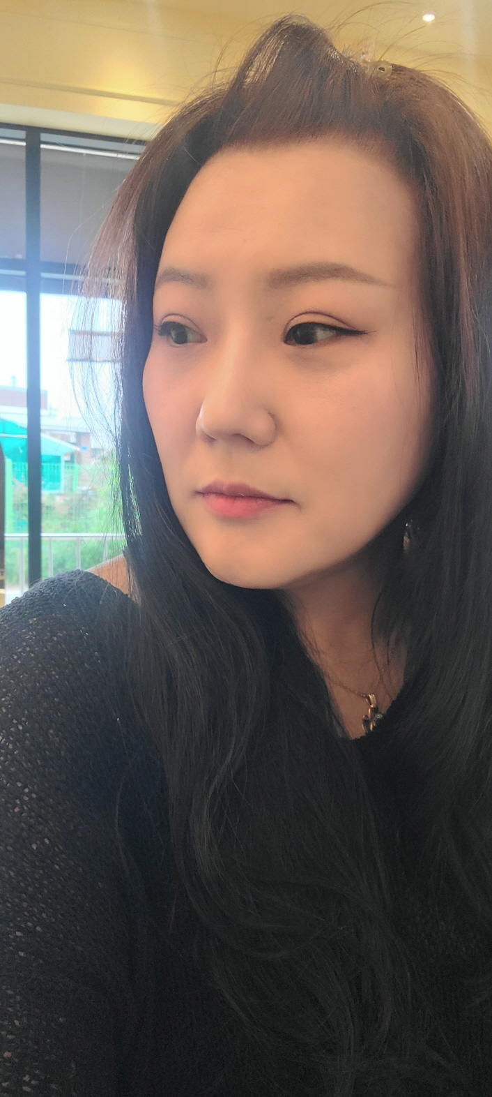 수술후기이미지