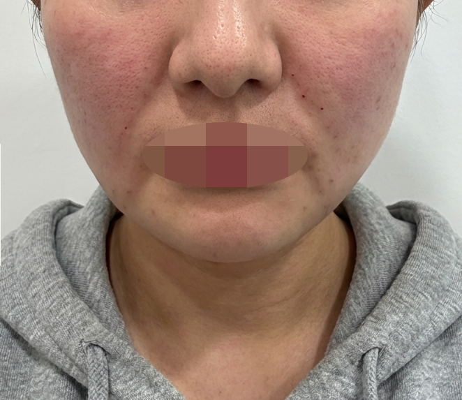 수술후기이미지