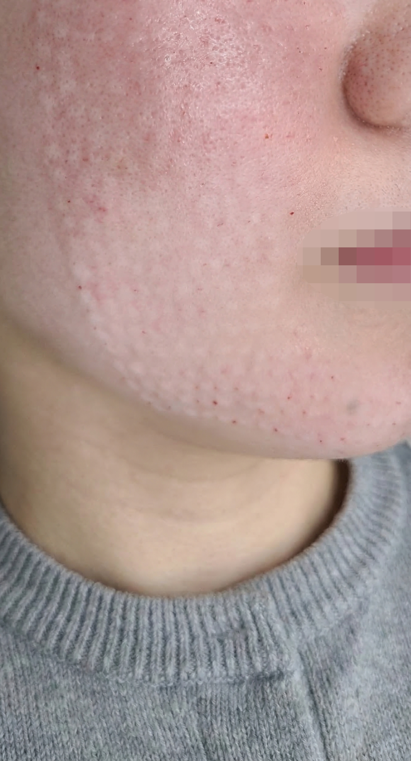 수술후기이미지