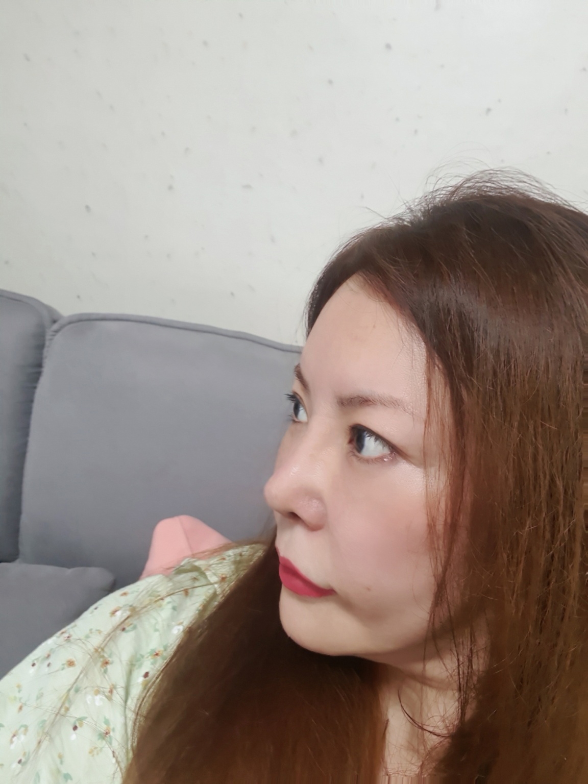 수술후기이미지