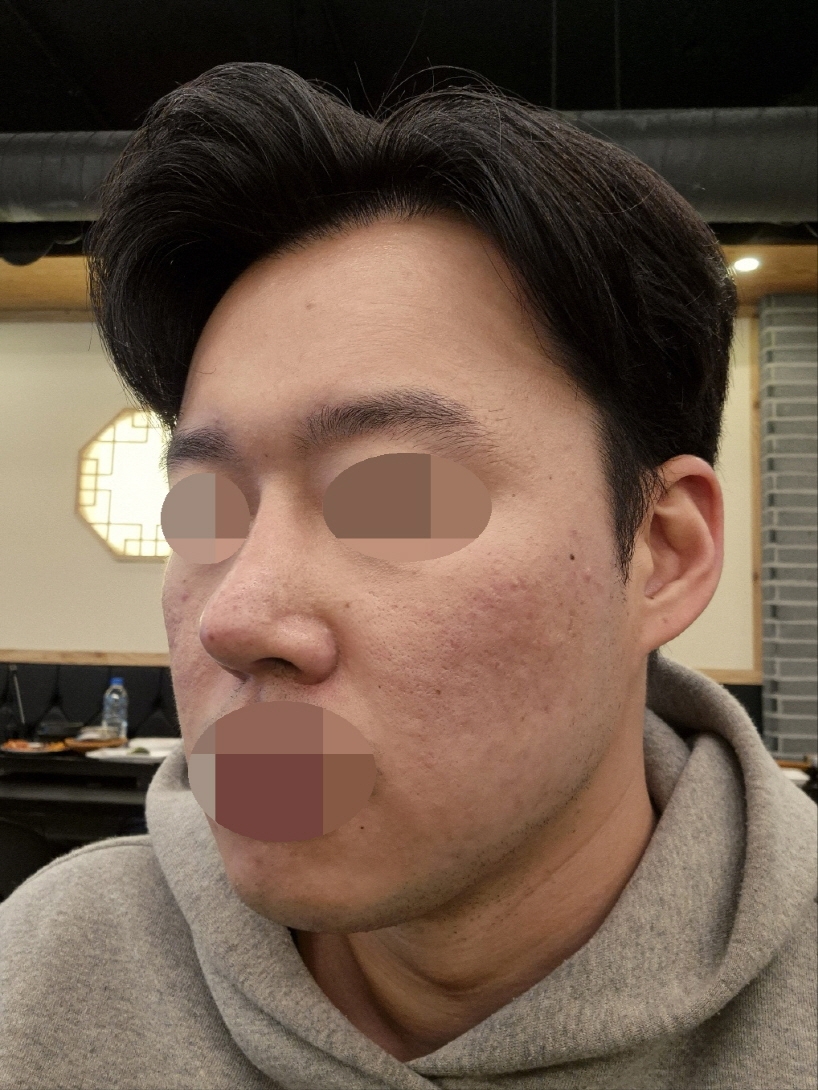 수술후기이미지