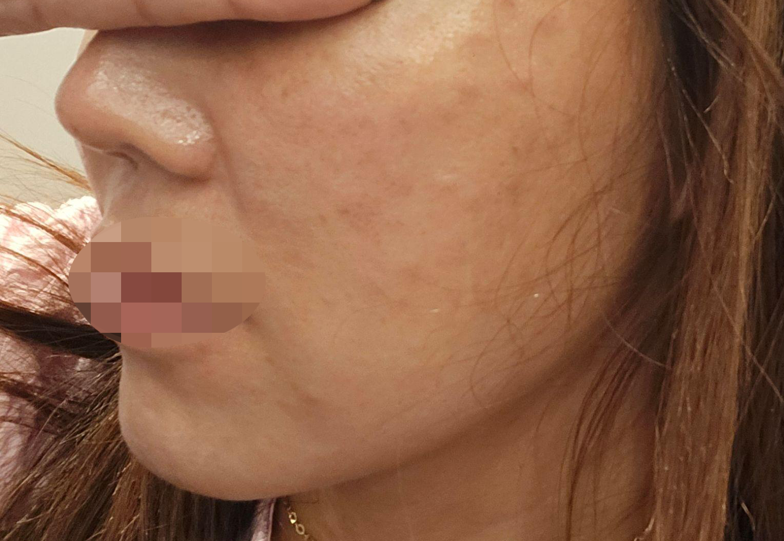 수술후기이미지