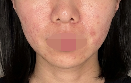 수술후기이미지