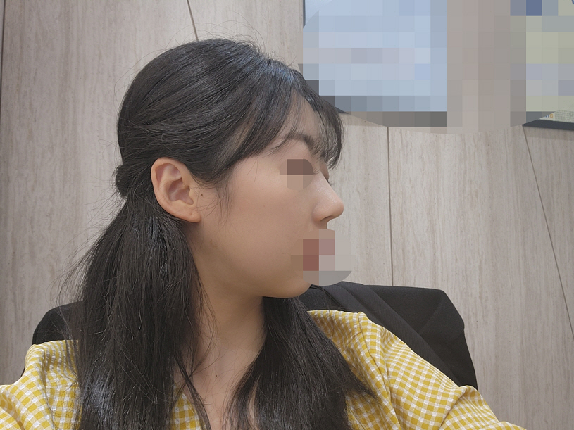 수술후기이미지