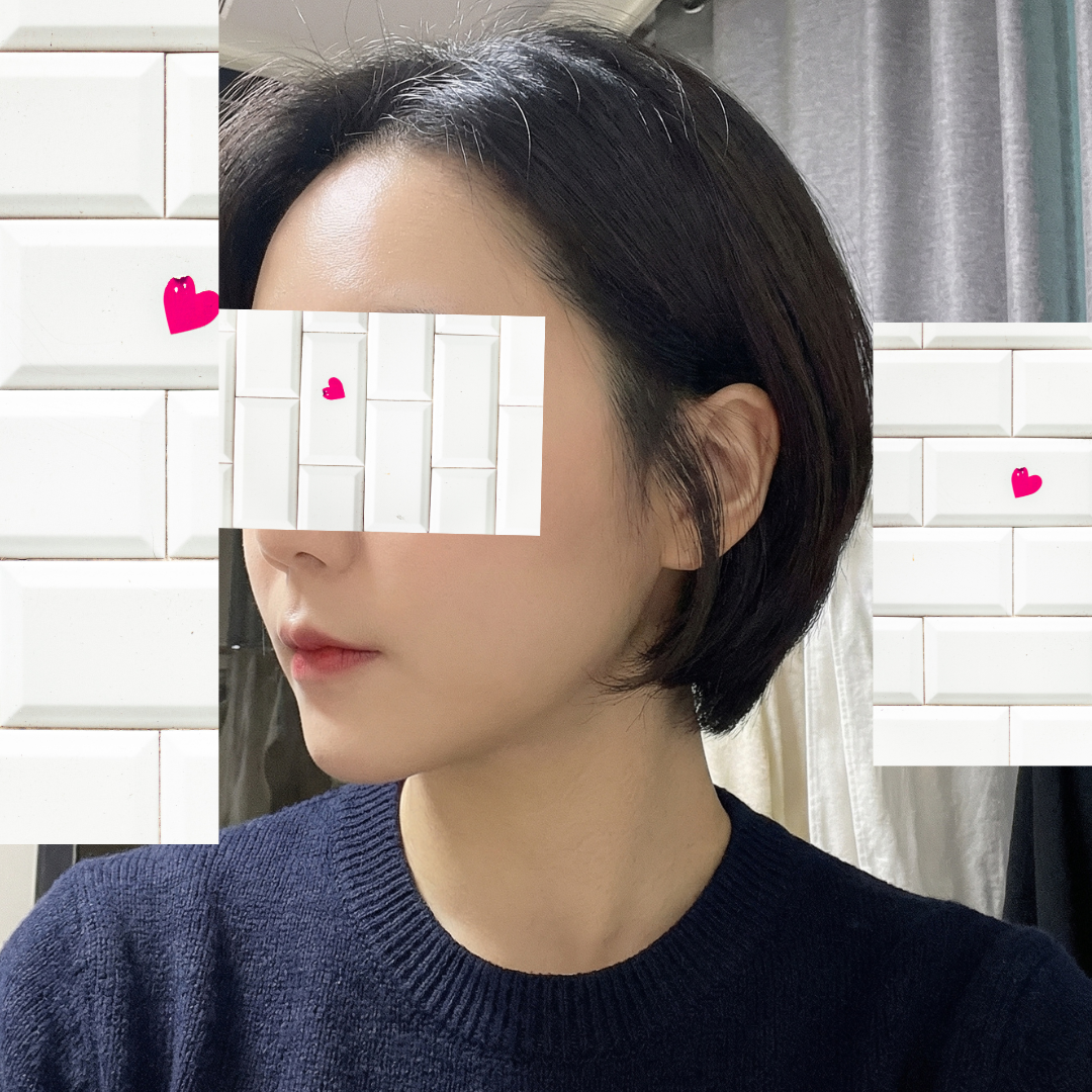 수술후기이미지