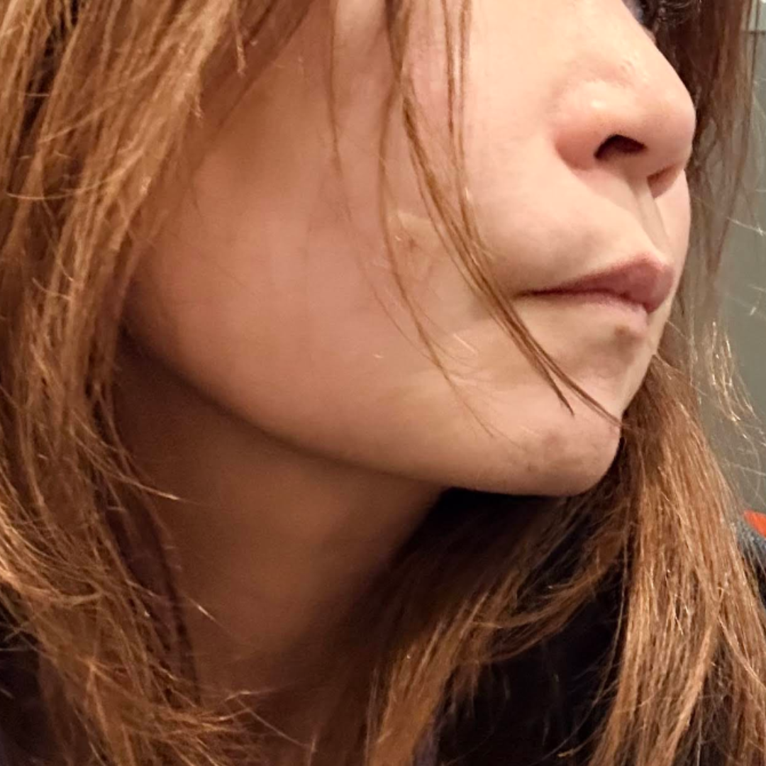 수술후기이미지