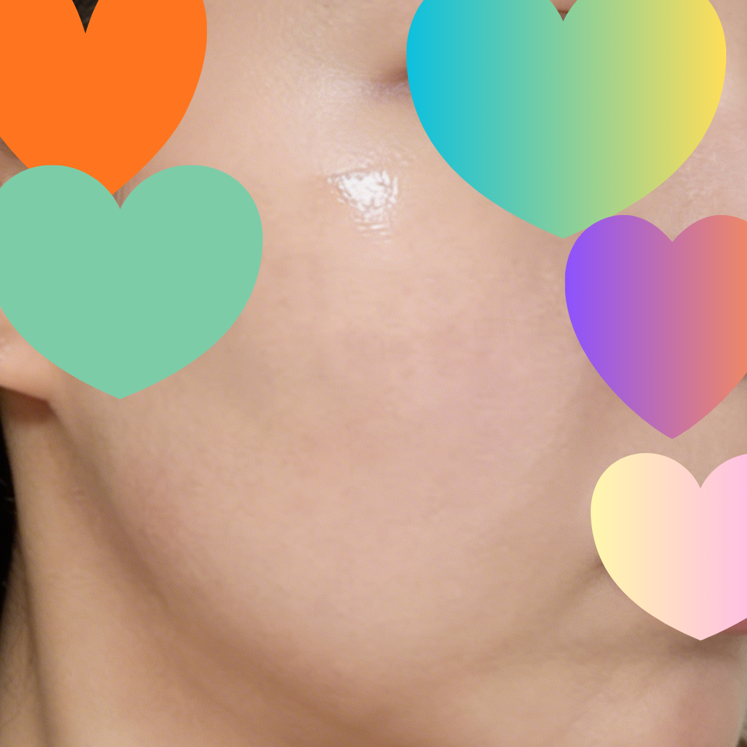 수술후기이미지