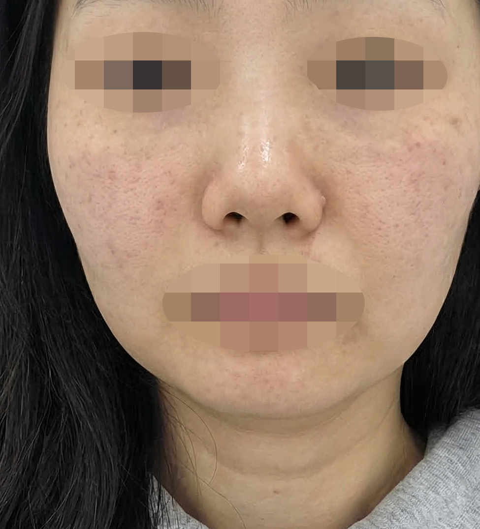 수술후기이미지