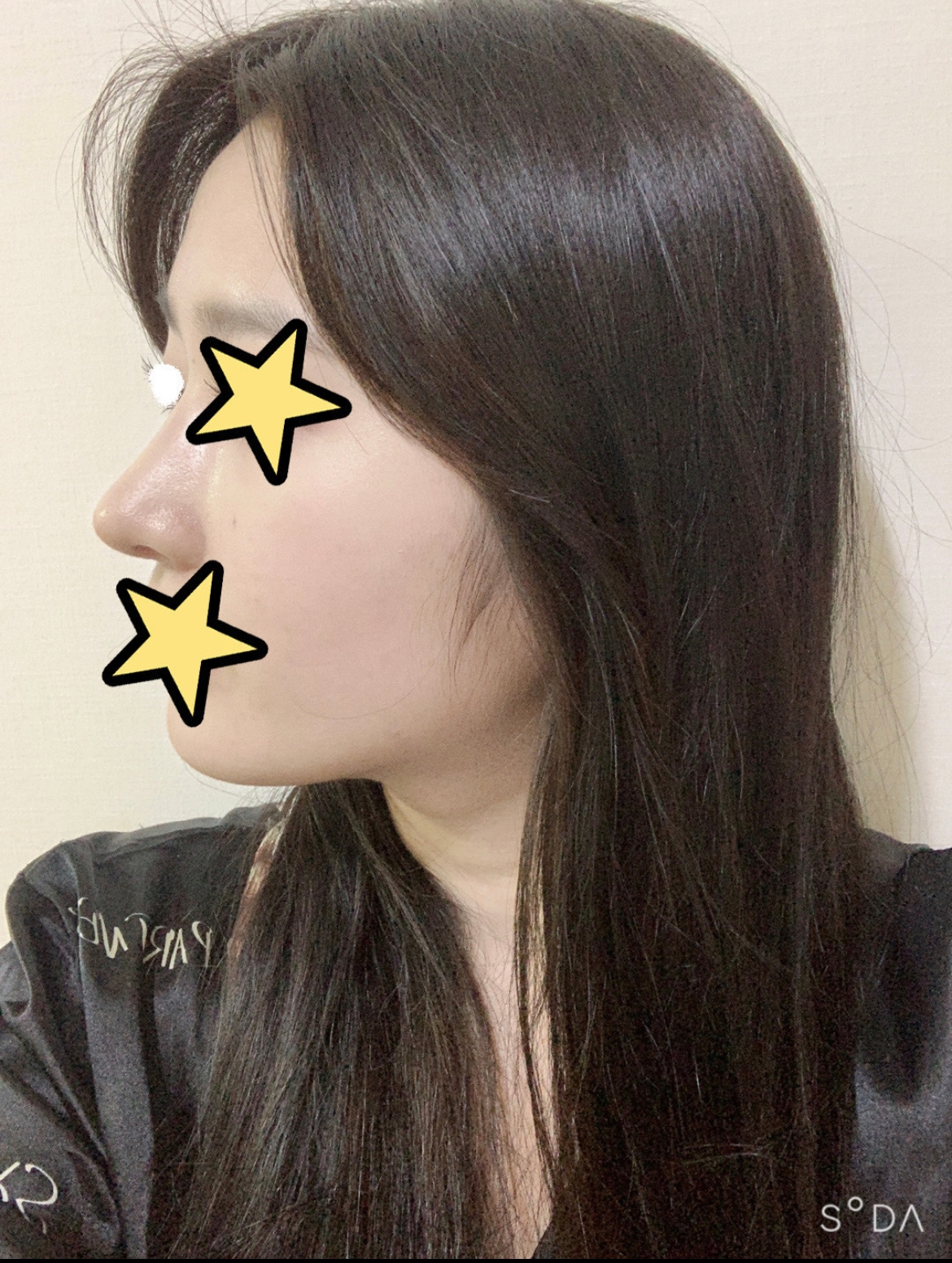 수술후기이미지