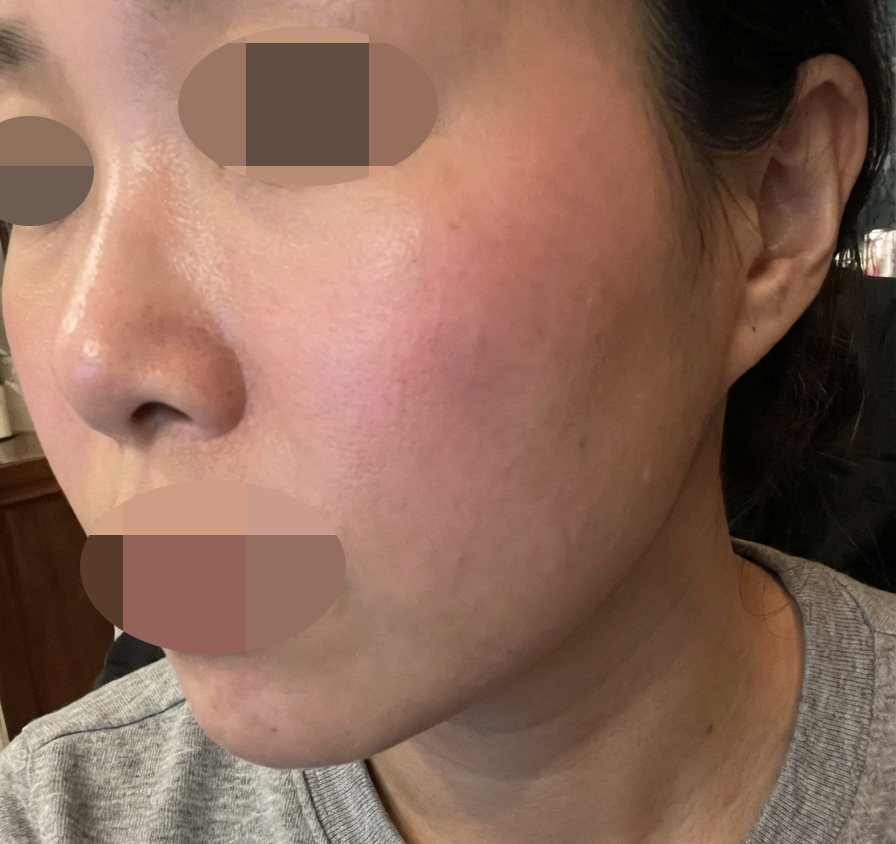 수술후기이미지