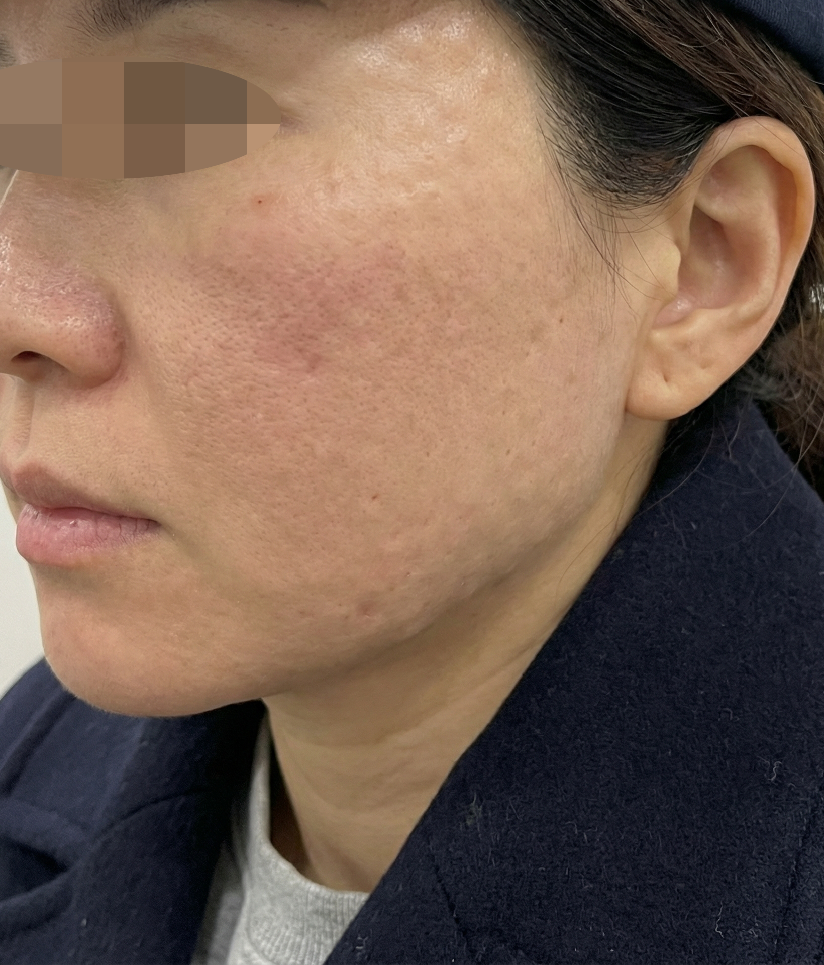 수술후기이미지