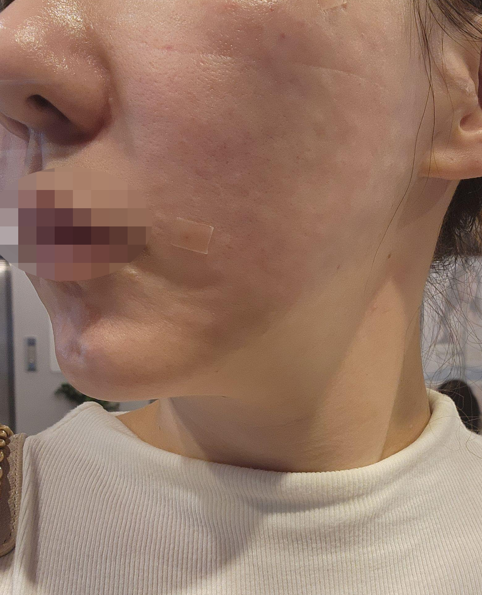 수술후기이미지