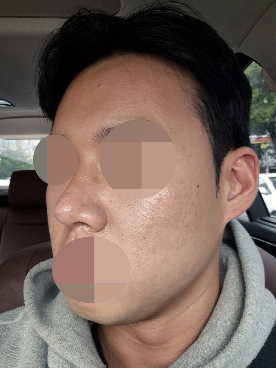 수술후기이미지