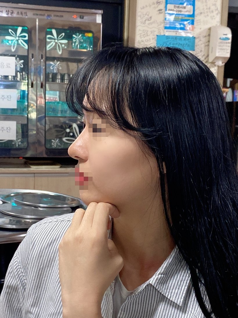 수술후기이미지