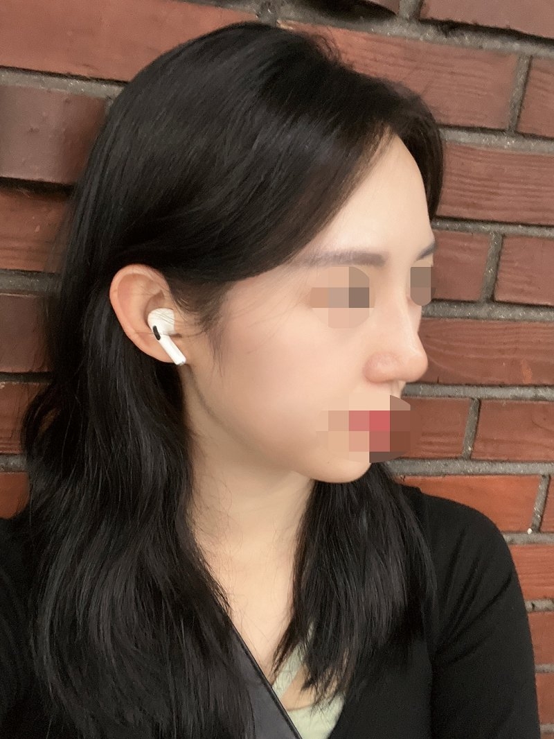 수술후기이미지