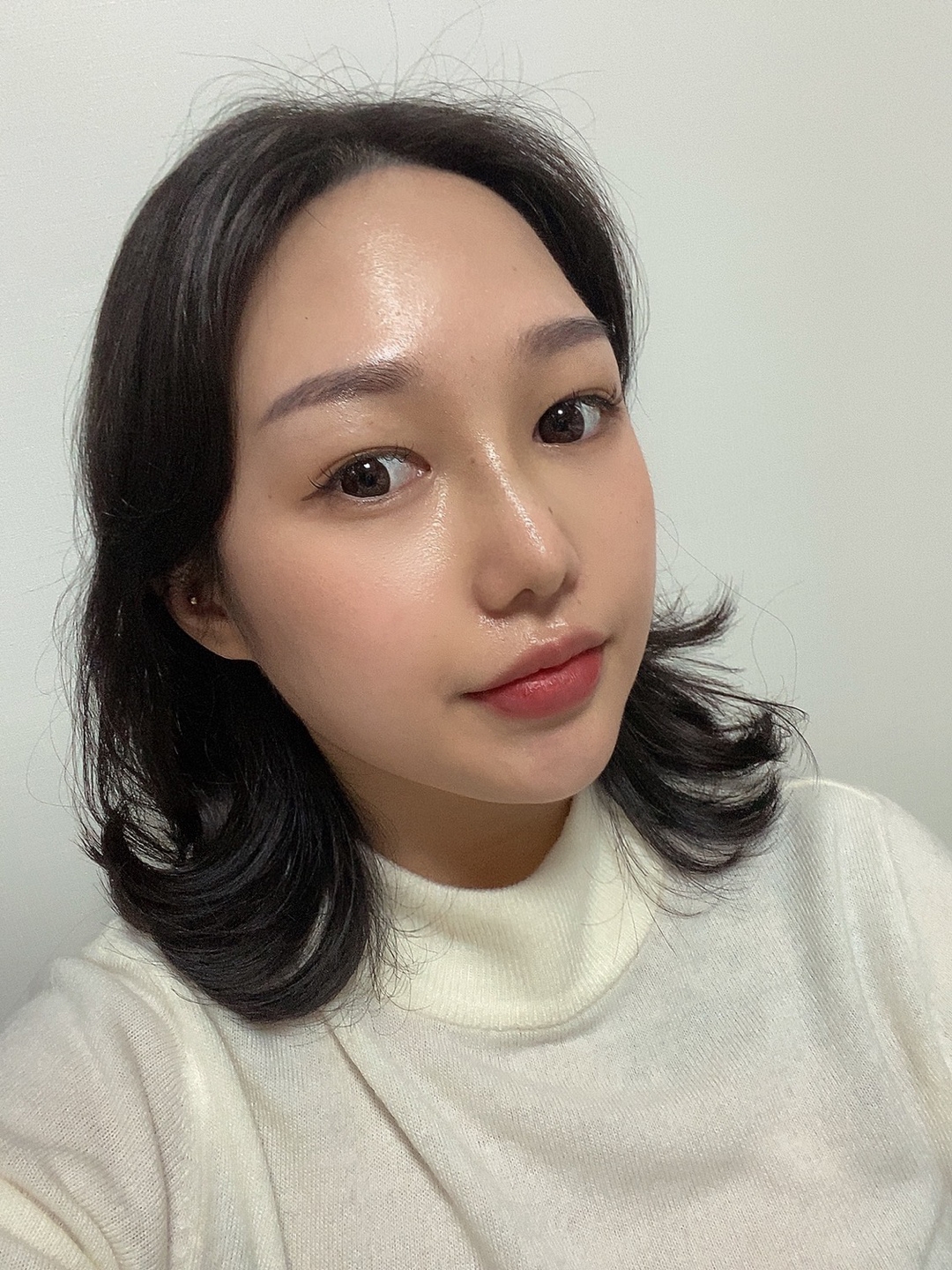 수술후기이미지