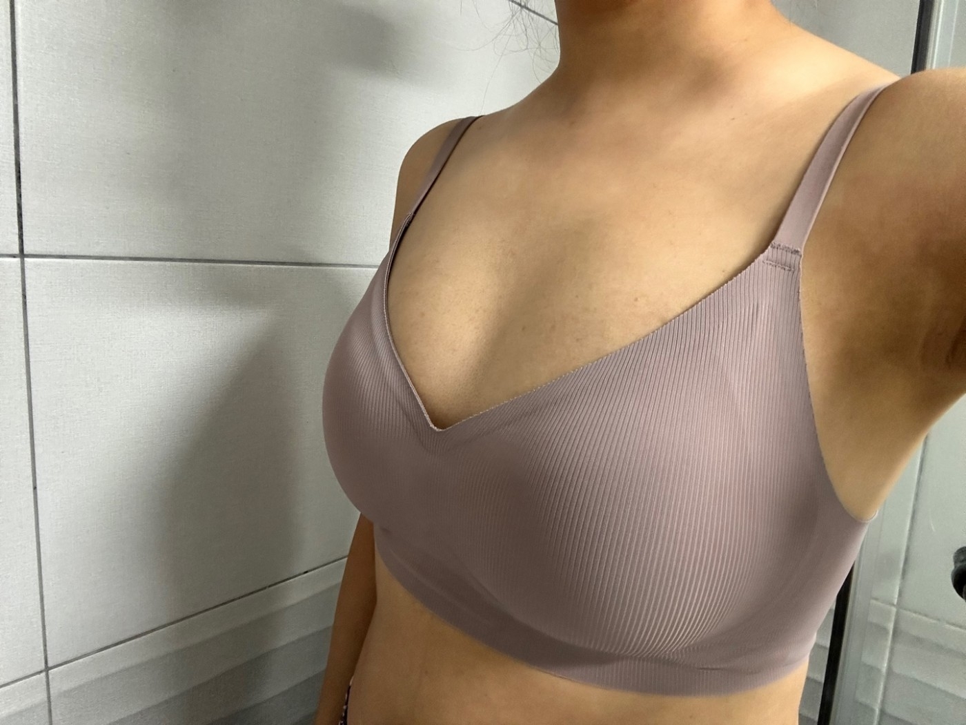 수술후기이미지