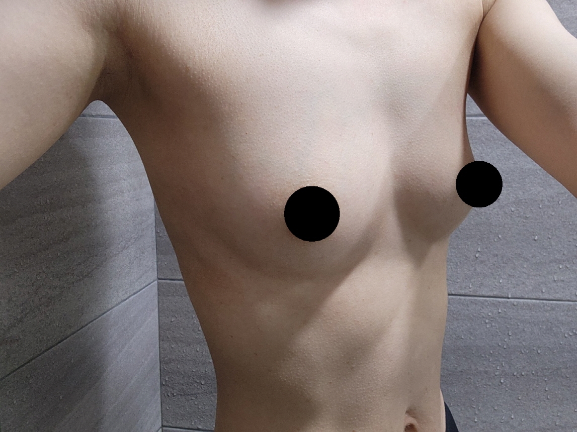 수술후기이미지