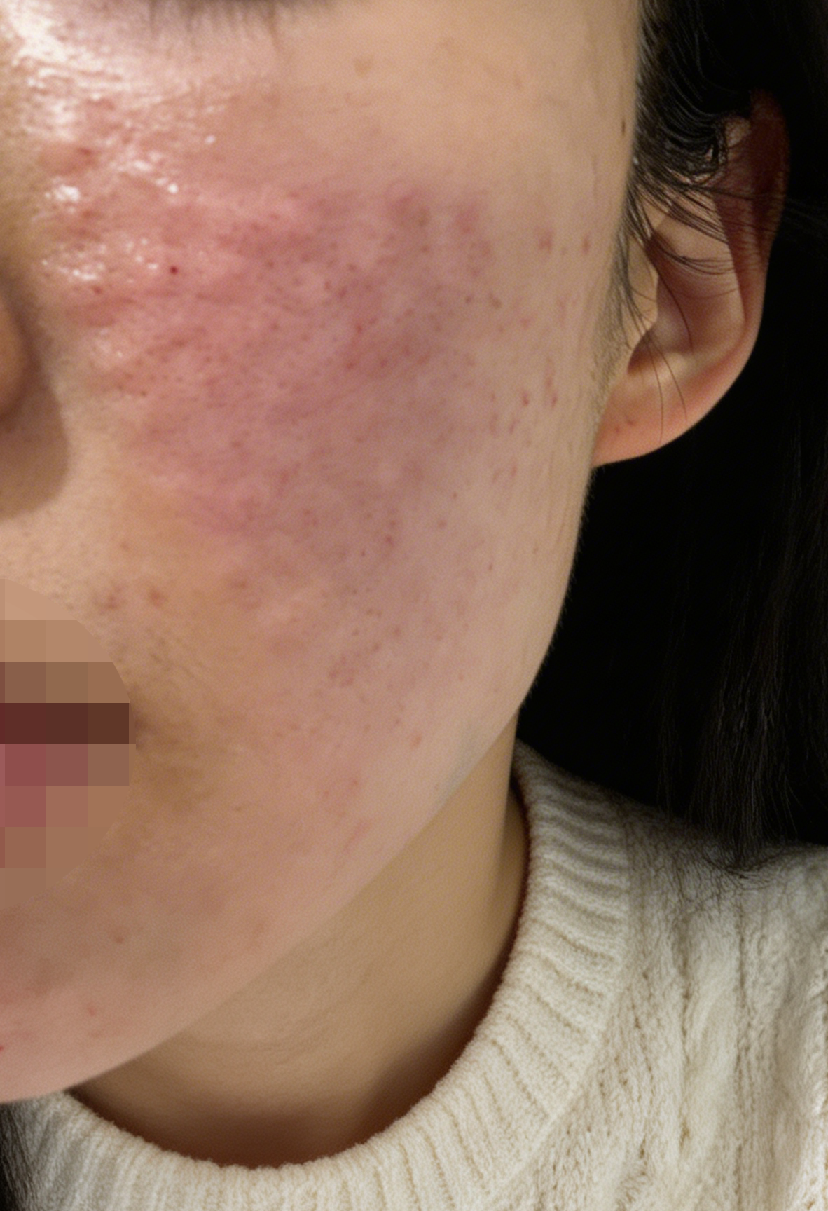 수술후기이미지