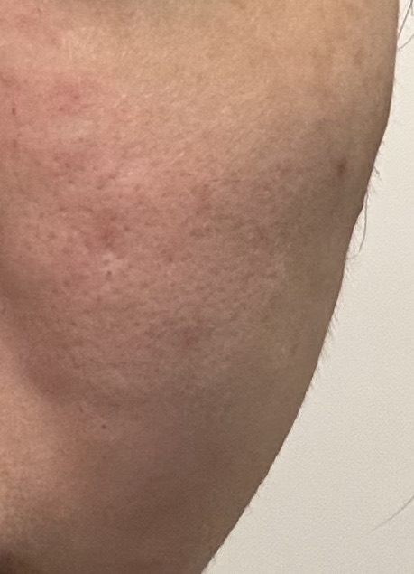 수술후기이미지