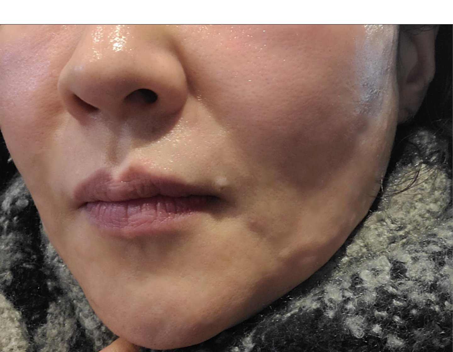 수술후기이미지