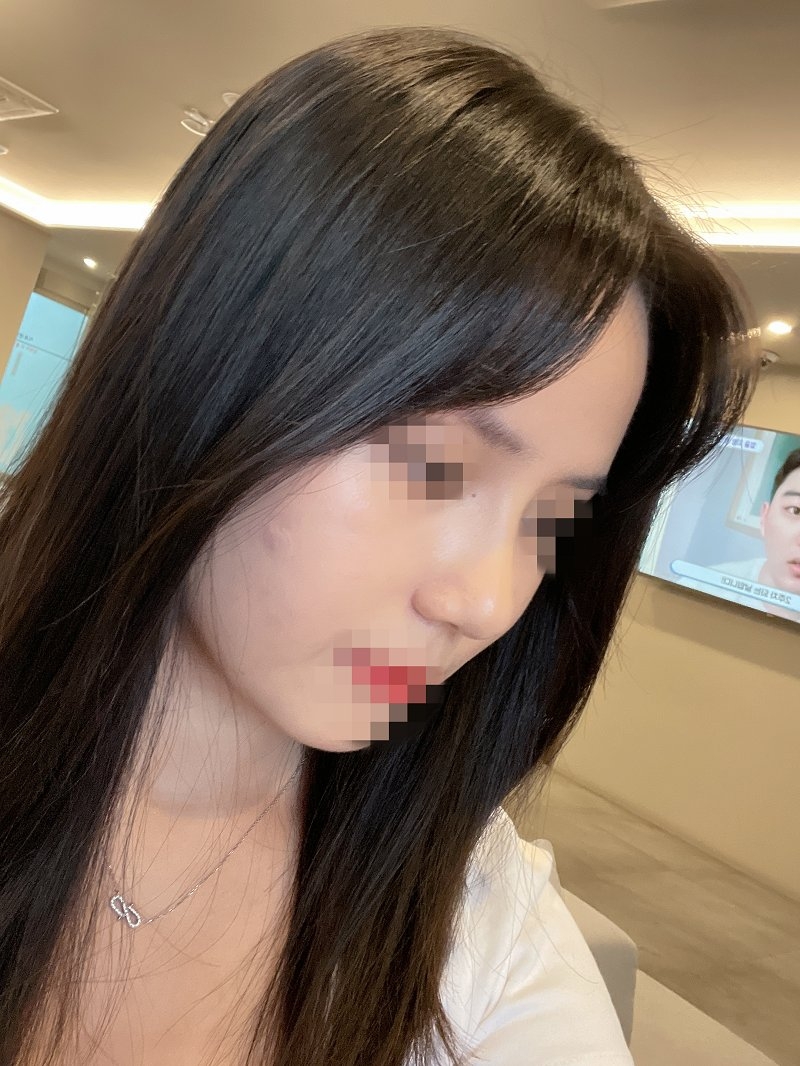 수술후기이미지