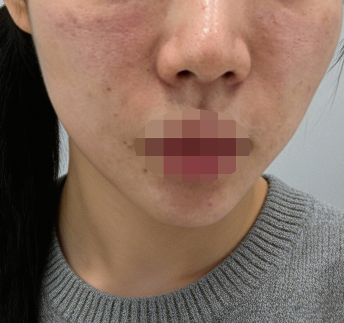 수술후기이미지