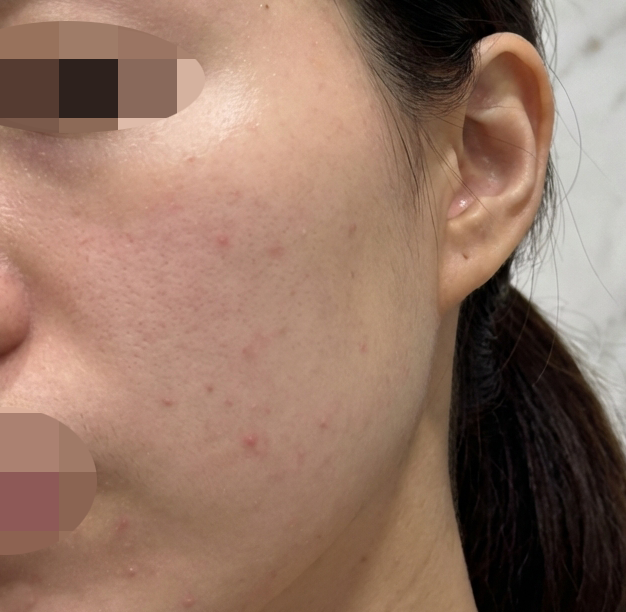 수술후기이미지