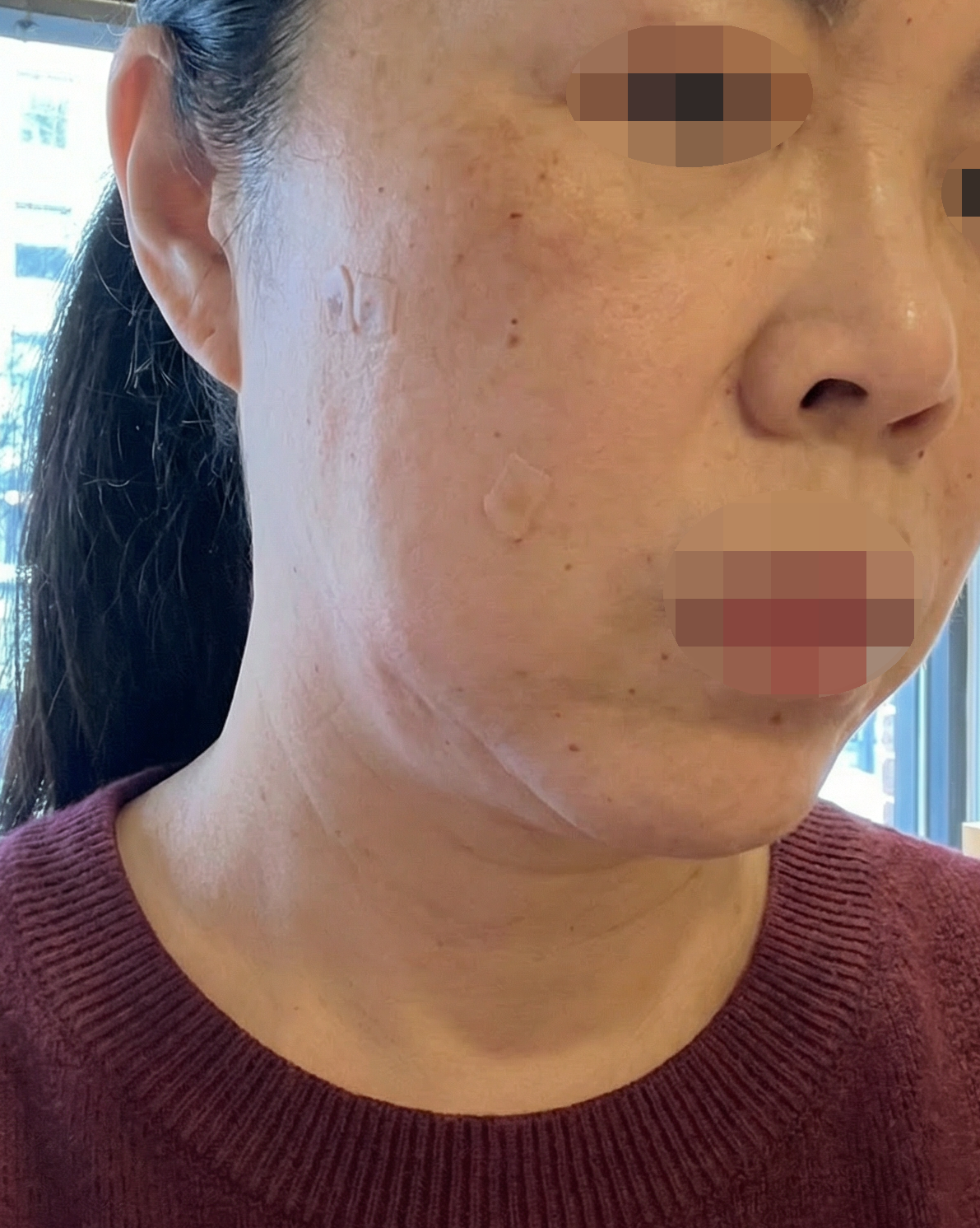 수술후기이미지