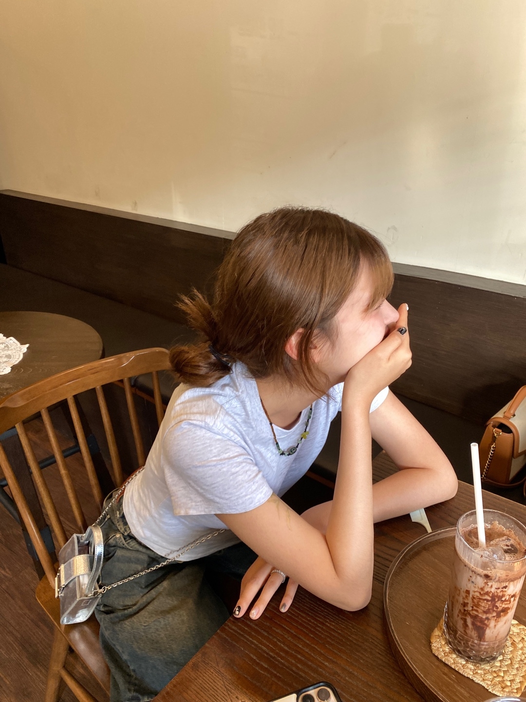 수술후기이미지