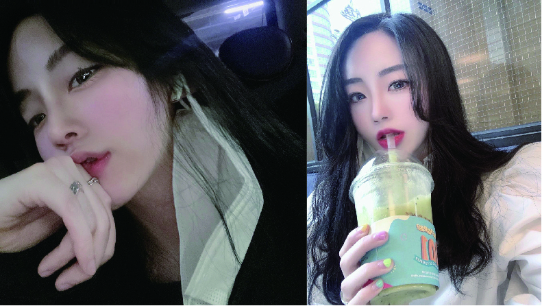 수술후기이미지