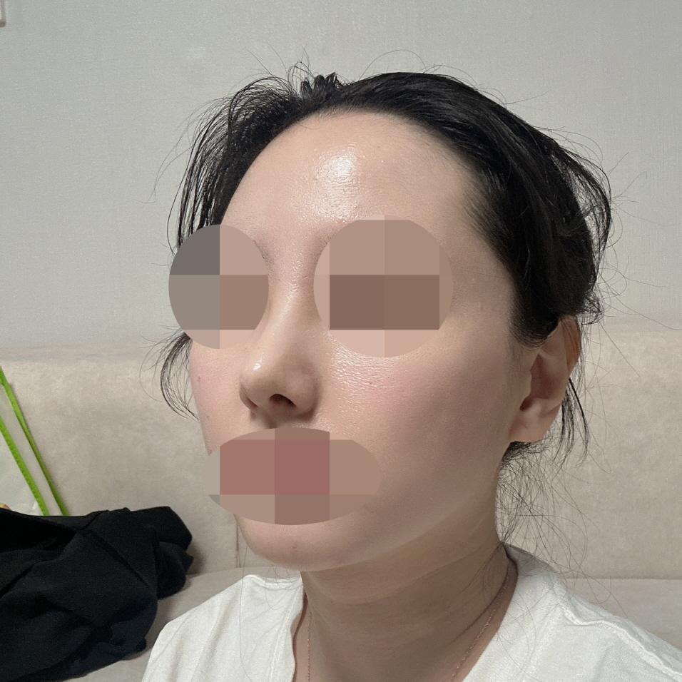 수술후기이미지