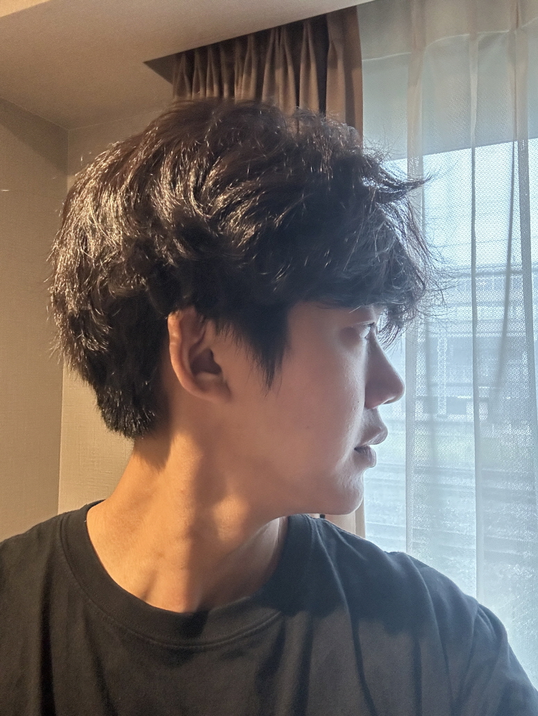 수술후기이미지