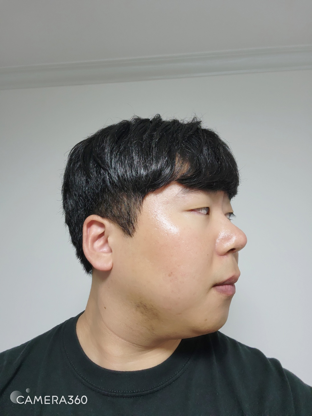 수술후기이미지