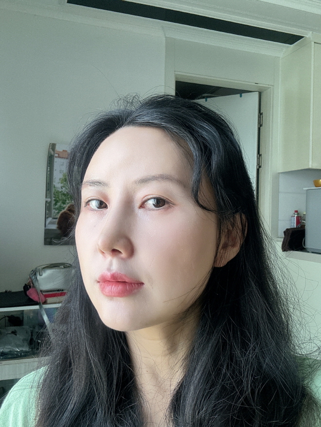 수술후기이미지