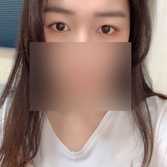 수술후기이미지