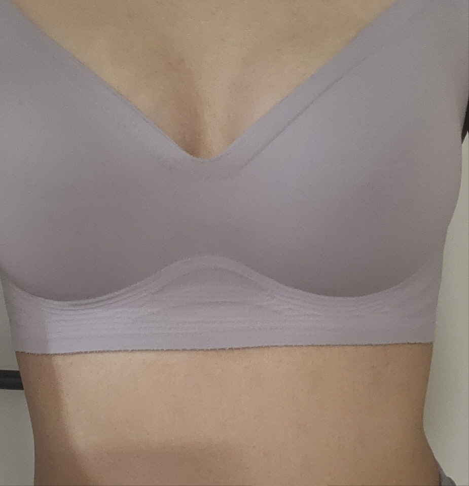 수술후기이미지